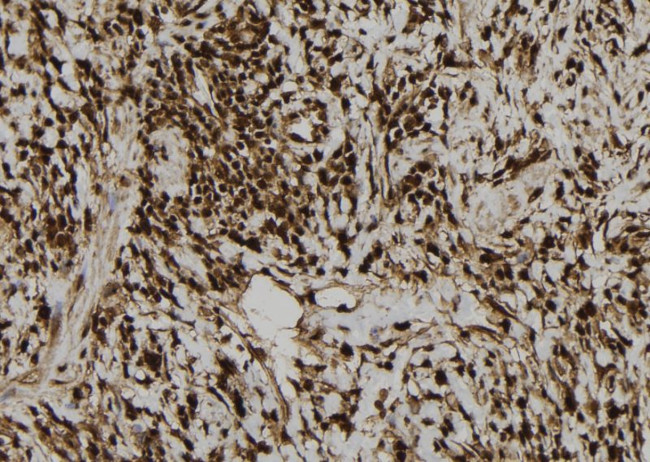 DNA Ligase III Antibody in Immunohistochemistry (Paraffin) (IHC (P))