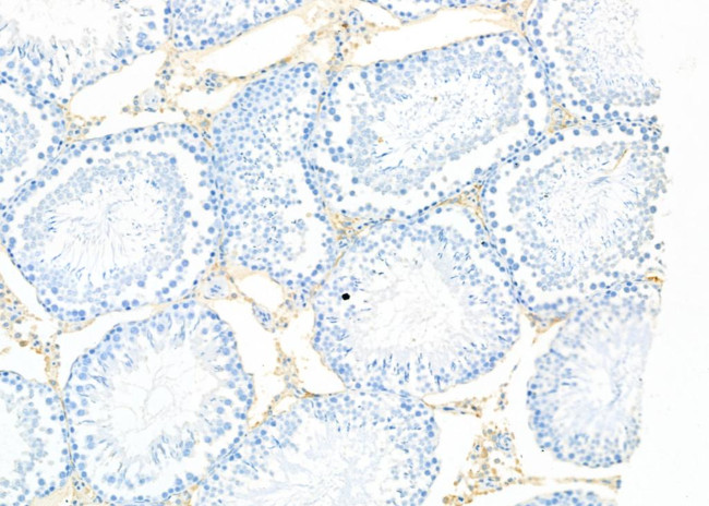 CADM1 Antibody in Immunohistochemistry (Paraffin) (IHC (P))