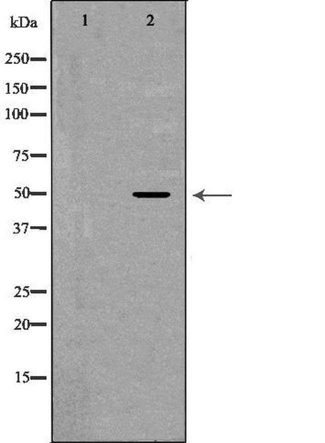 CADM1 Antibody in Western Blot (WB)