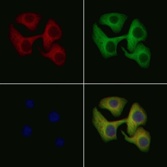 IL1R2 Antibody in Immunocytochemistry (ICC/IF)