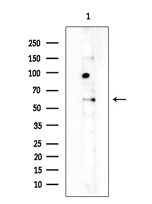 Uromodulin Antibody in Western Blot (WB)