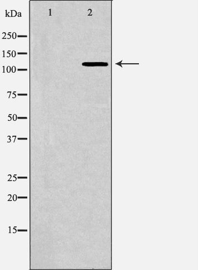 Bub1 Antibody in Western Blot (WB)