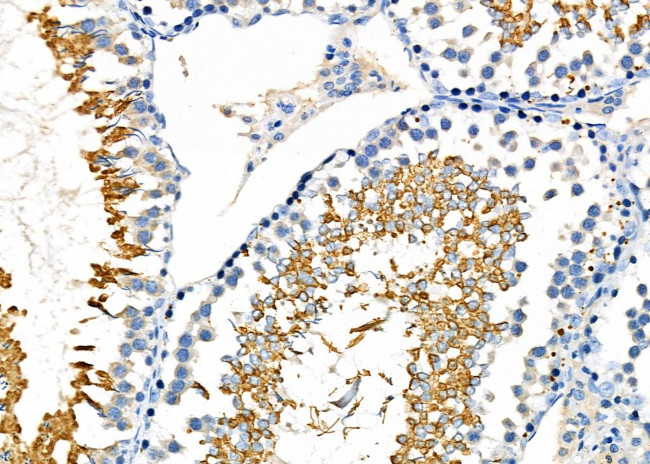 GPX4 Antibody in Immunohistochemistry (Paraffin) (IHC (P))