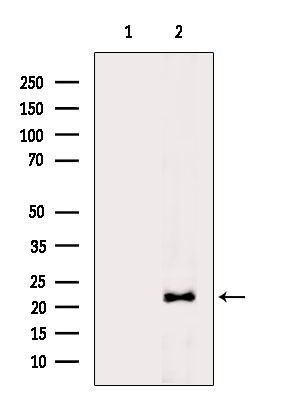 GPX4 Antibody in Western Blot (WB)