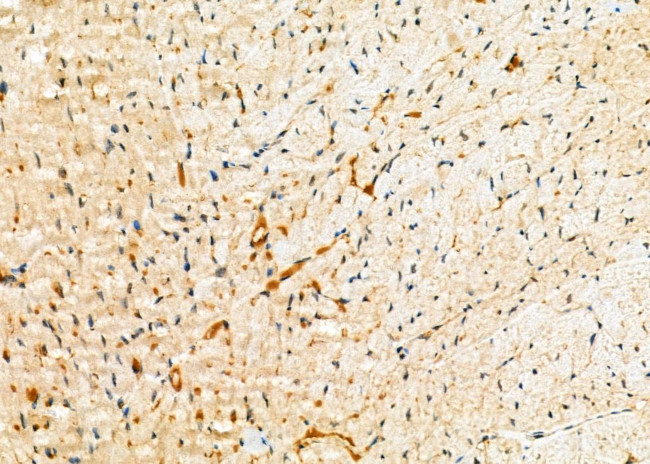 RAB27A Antibody in Immunohistochemistry (Paraffin) (IHC (P))