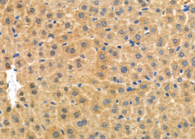 RAB27A Antibody in Immunohistochemistry (Paraffin) (IHC (P))