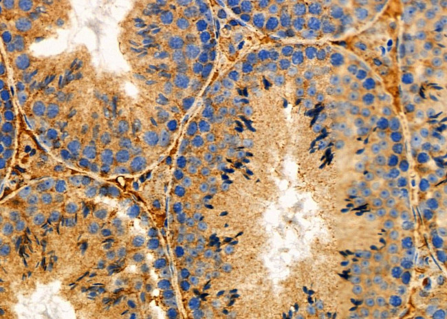 RCAS1 Antibody in Immunohistochemistry (Paraffin) (IHC (P))