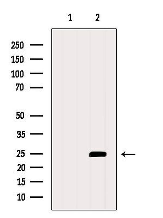 RCAS1 Antibody in Western Blot (WB)