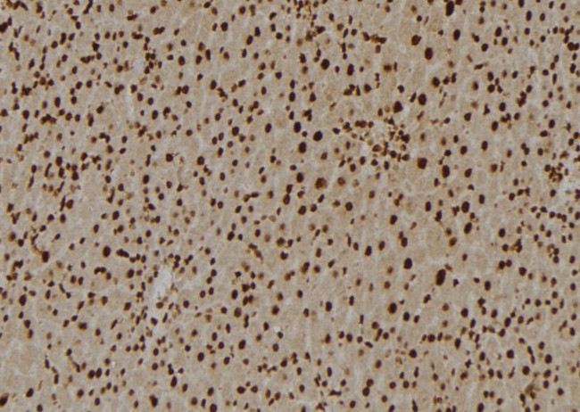 U2AF2 Antibody in Immunohistochemistry (Paraffin) (IHC (P))