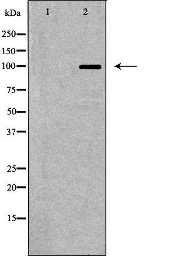 GluR6 Antibody in Western Blot (WB)