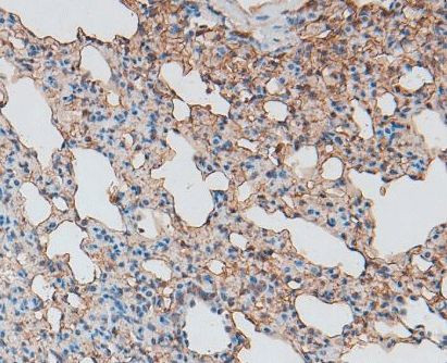 Glypican 3 Antibody in Immunohistochemistry (Paraffin) (IHC (P))