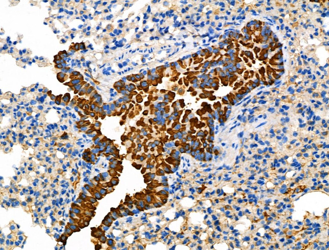 Glypican 3 Antibody in Immunohistochemistry (Paraffin) (IHC (P))