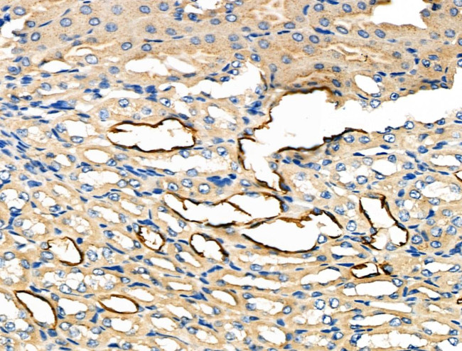 Glypican 3 Antibody in Immunohistochemistry (Paraffin) (IHC (P))