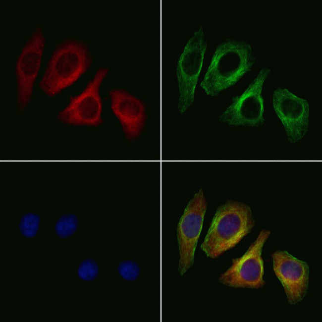 Glypican 3 Antibody in Immunocytochemistry (ICC/IF)