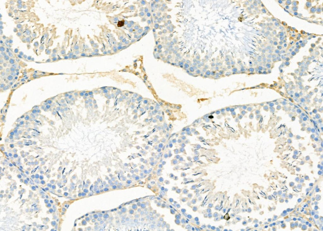 ODC1 Antibody in Immunohistochemistry (Paraffin) (IHC (P))