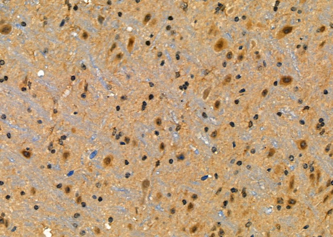 PSMD10 Antibody in Immunohistochemistry (Paraffin) (IHC (P))