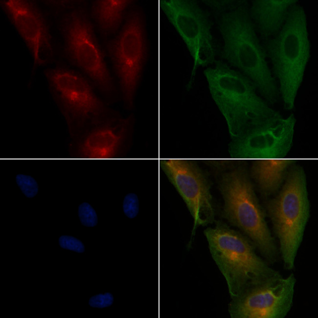 UBE2D1 Antibody in Immunocytochemistry (ICC/IF)