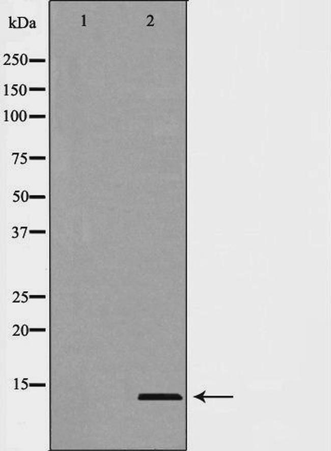 MSMB Antibody in Western Blot (WB)