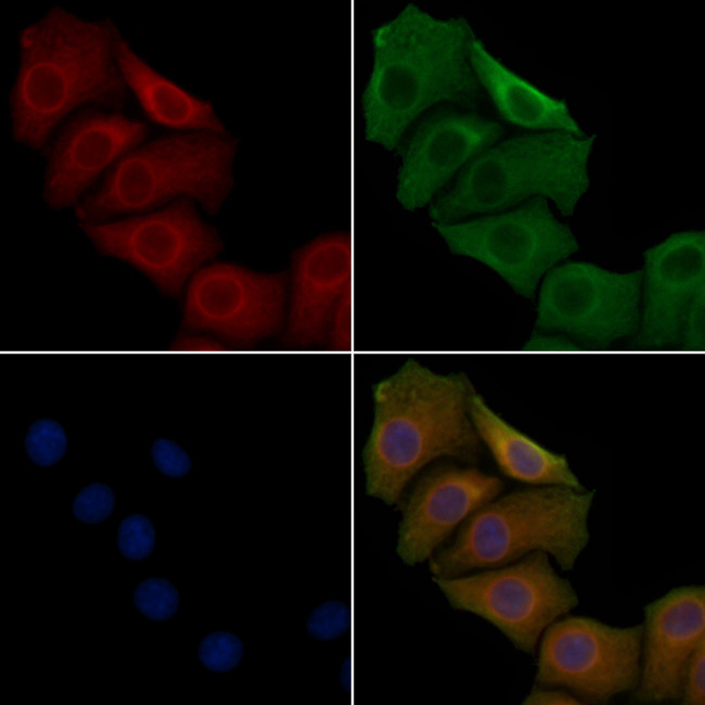 HSD17B2 Antibody in Immunocytochemistry (ICC/IF)