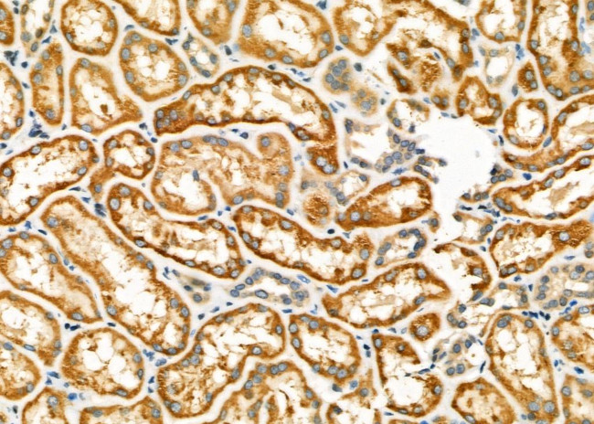 HSD17B2 Antibody in Immunohistochemistry (Paraffin) (IHC (P))