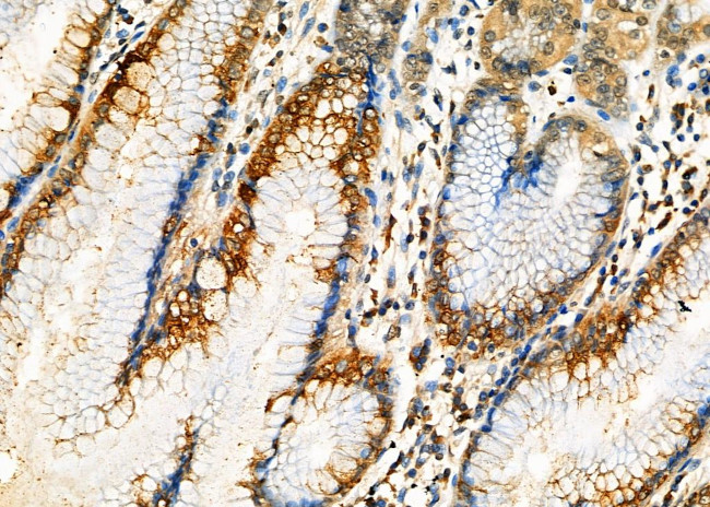 IPO5 Antibody in Immunohistochemistry (Paraffin) (IHC (P))