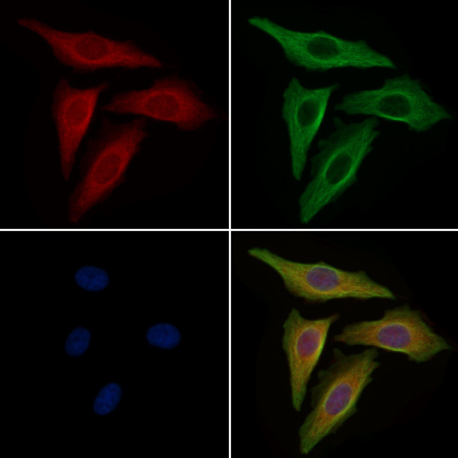 eIF5A Antibody in Immunocytochemistry (ICC/IF)