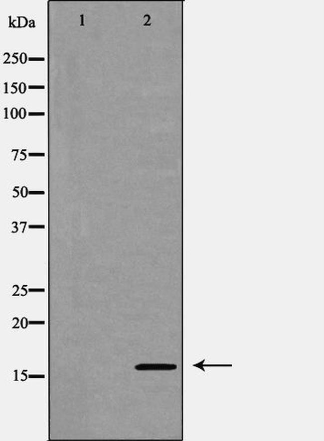 eIF5A Antibody in Western Blot (WB)