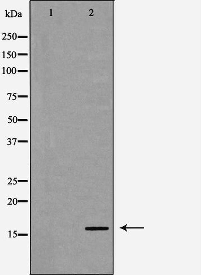 RPS19 Antibody in Western Blot (WB)