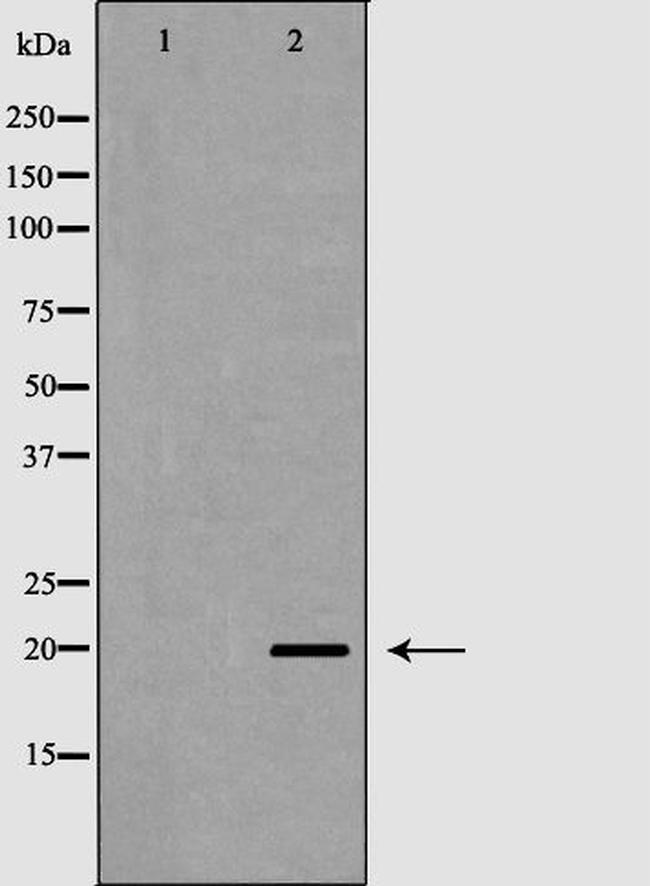 TAF9 Antibody in Western Blot (WB)