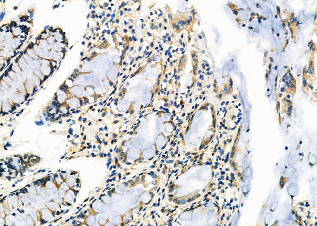 Ubiquitin Antibody in Immunohistochemistry (Paraffin) (IHC (P))