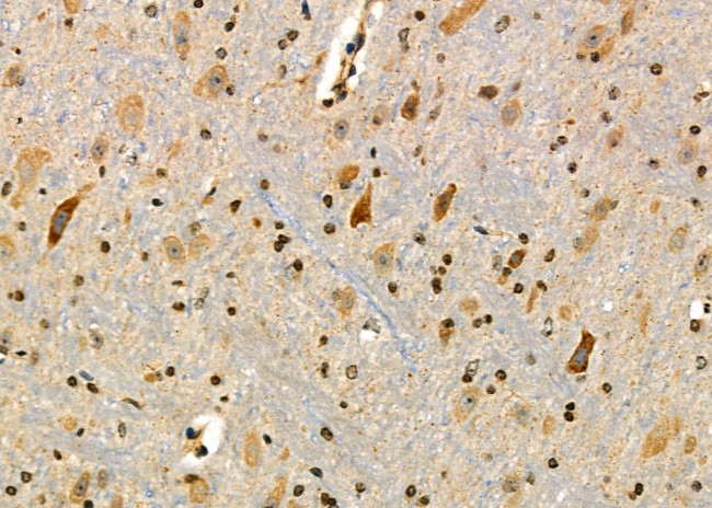 Ubiquitin Antibody in Immunohistochemistry (Paraffin) (IHC (P))