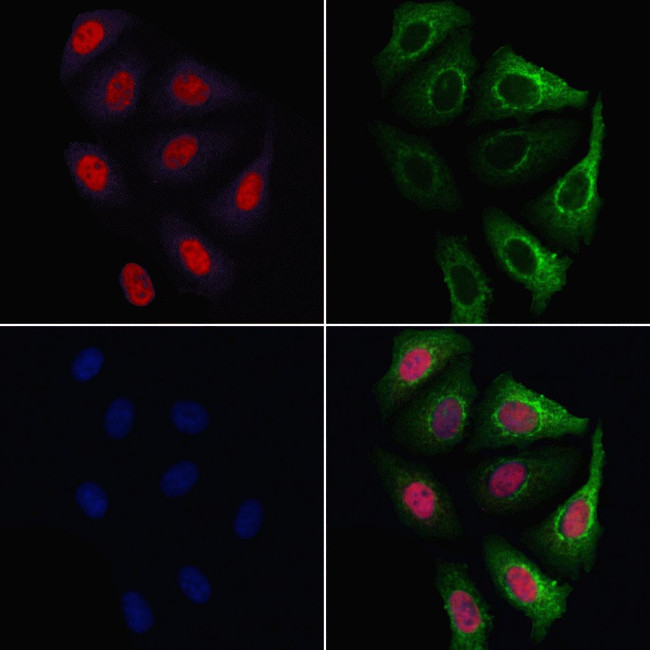 Ubiquitin Antibody in Immunocytochemistry (ICC/IF)