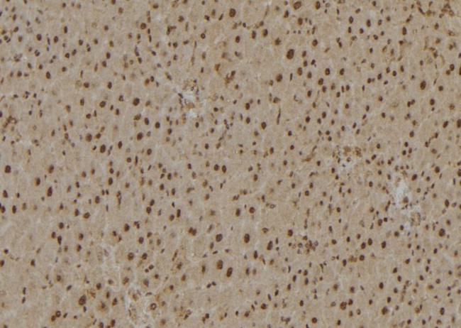 Ubiquitin Antibody in Immunohistochemistry (Paraffin) (IHC (P))