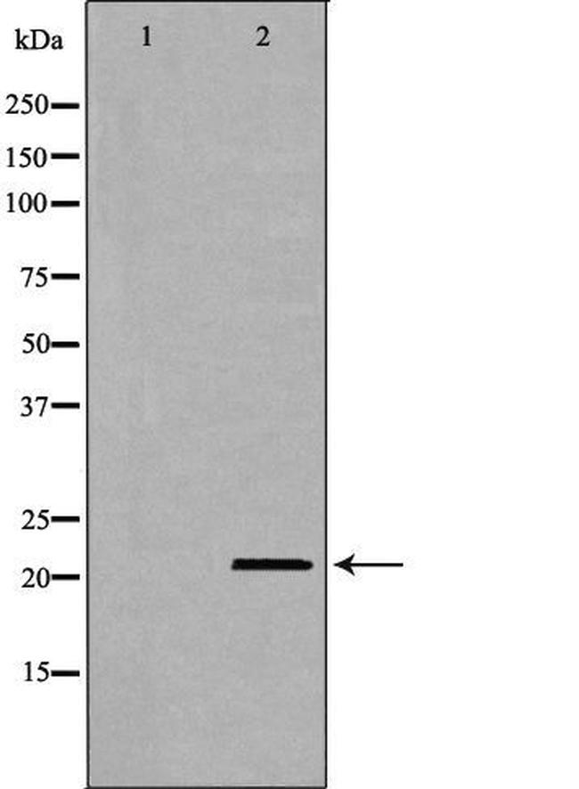 CD70 Antibody in Western Blot (WB)