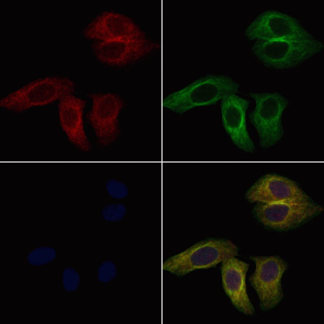 CD94 Antibody in Immunocytochemistry (ICC/IF)