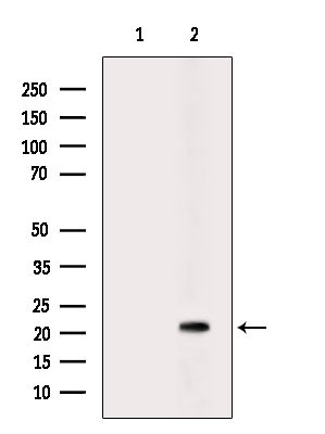 CD94 Antibody in Western Blot (WB)