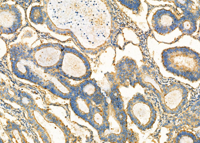 ADH5 Antibody in Immunohistochemistry (Paraffin) (IHC (P))