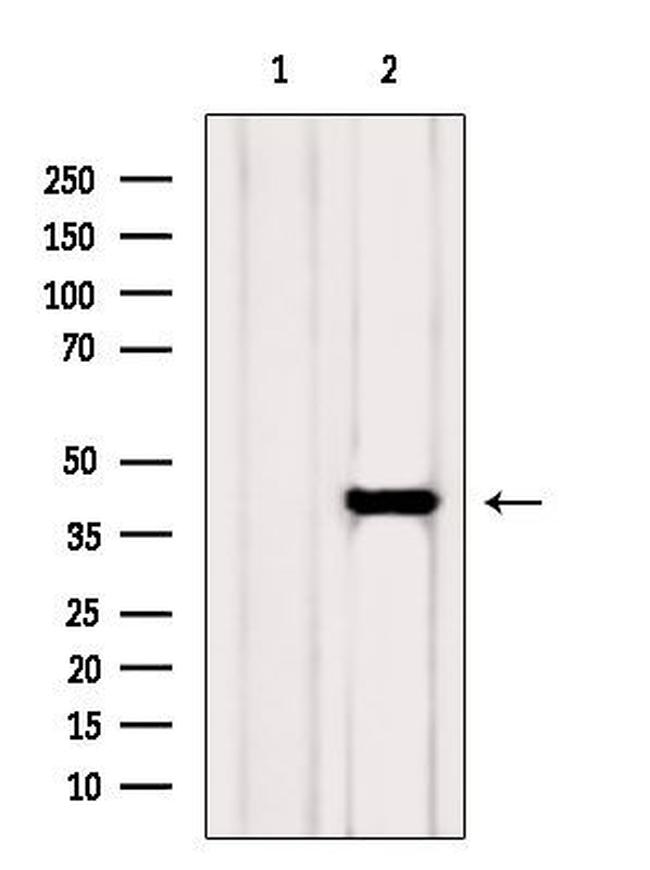 ADH5 Antibody in Western Blot (WB)