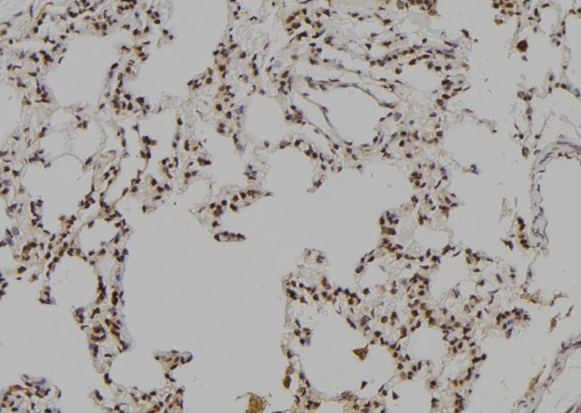 LHX8 Antibody in Immunohistochemistry (Paraffin) (IHC (P))