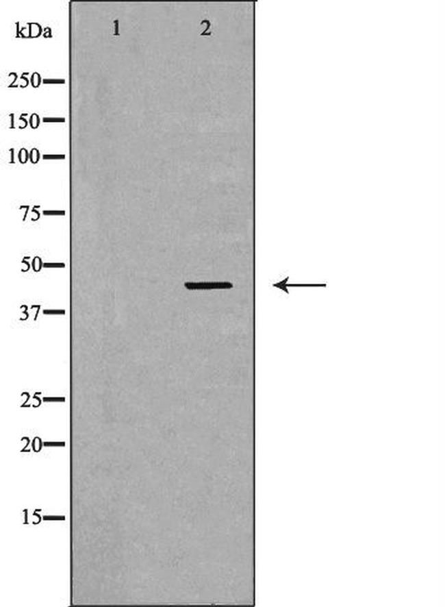 LHX8 Antibody in Western Blot (WB)