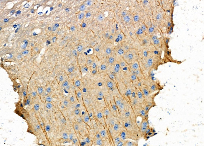 EPHX1 Antibody in Immunohistochemistry (Paraffin) (IHC (P))