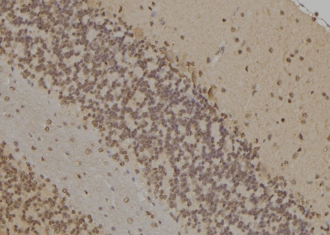 FANCD2 Antibody in Immunohistochemistry (Paraffin) (IHC (P))