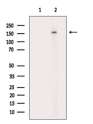 FANCD2 Antibody in Western Blot (WB)