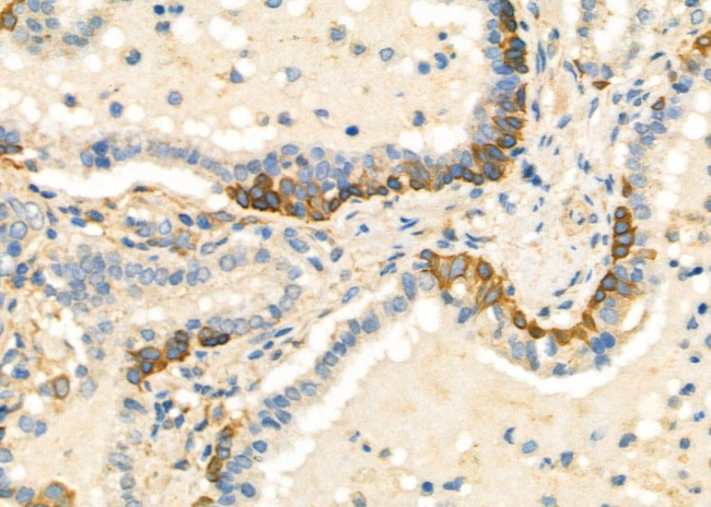 IL-13 Antibody in Immunohistochemistry (Paraffin) (IHC (P))