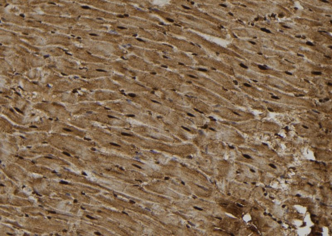 PKC epsilon Antibody in Immunohistochemistry (Paraffin) (IHC (P))