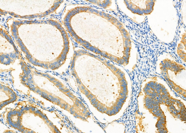 Sorbitol Dehydrogenase Antibody in Immunohistochemistry (Paraffin) (IHC (P))