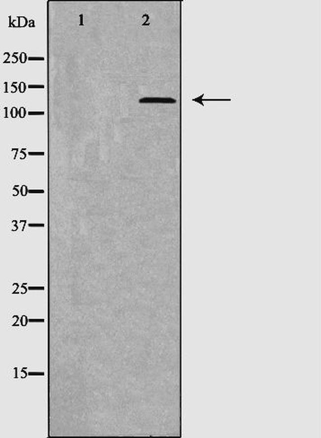 Thrombospondin 1 Antibody in Western Blot (WB)