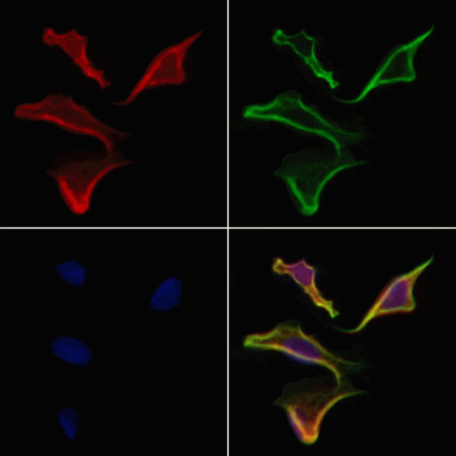 NUMBL Antibody in Immunocytochemistry (ICC/IF)