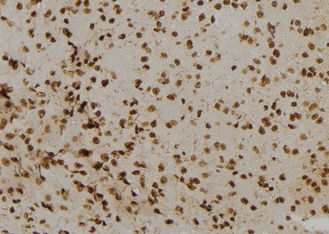 NUMBL Antibody in Immunohistochemistry (Paraffin) (IHC (P))