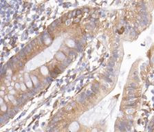 REG3G Antibody in Immunohistochemistry (Paraffin) (IHC (P))